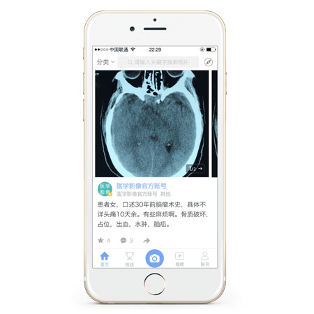 醫療影像APP開(kāi)發(fā)