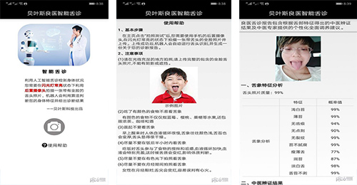 智能輔診APP開(kāi)發(fā)